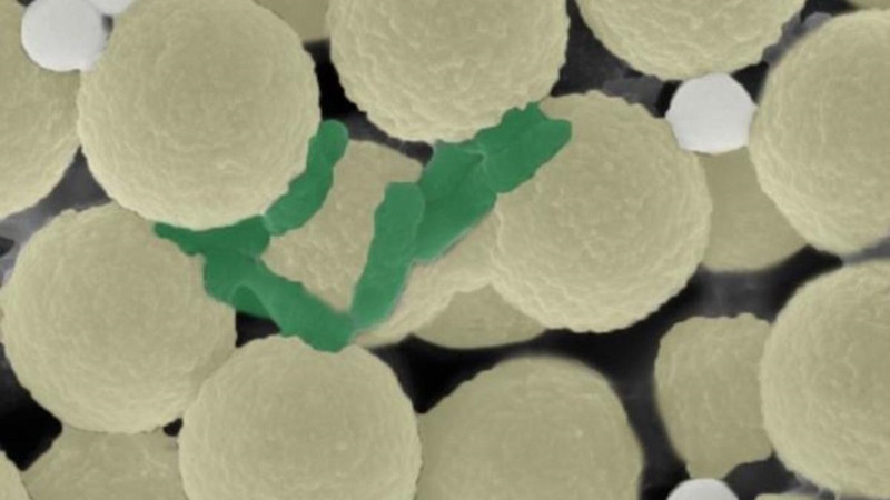 На снимке, сделанном под микроскопом (выше), видны микророботы (желтые), а также захваченные бактерии (зеленые) и крошечные кусочки пластика (белые)