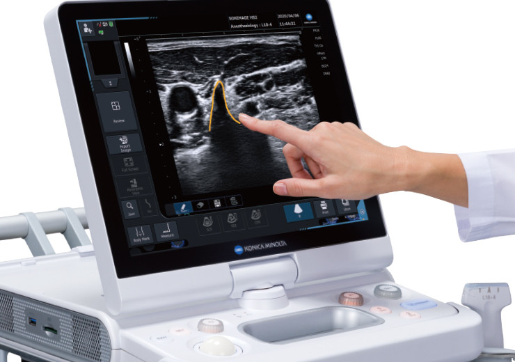 Sonimage HS2